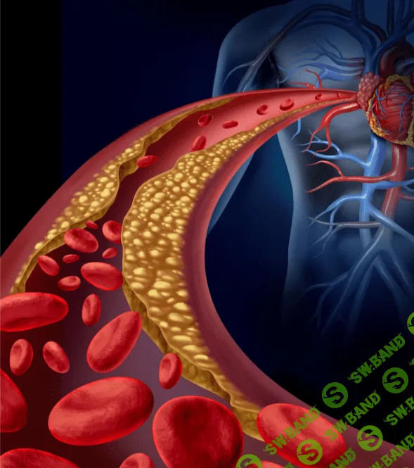 [Fantel] Школа Холестерина (2023)