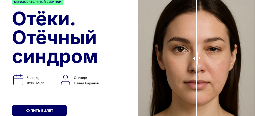 [Павел Баранов] Отёки. Отёчный синдром (2025)