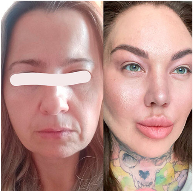 [Ярослава Науменко] Антиэйдж в большом городе (2025)